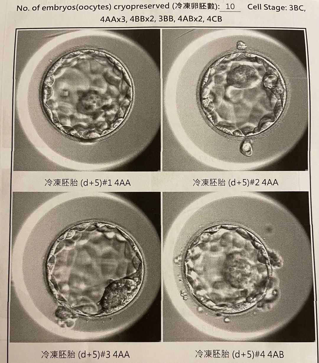 求子放生什么最好？，放生究竟有什么好处-