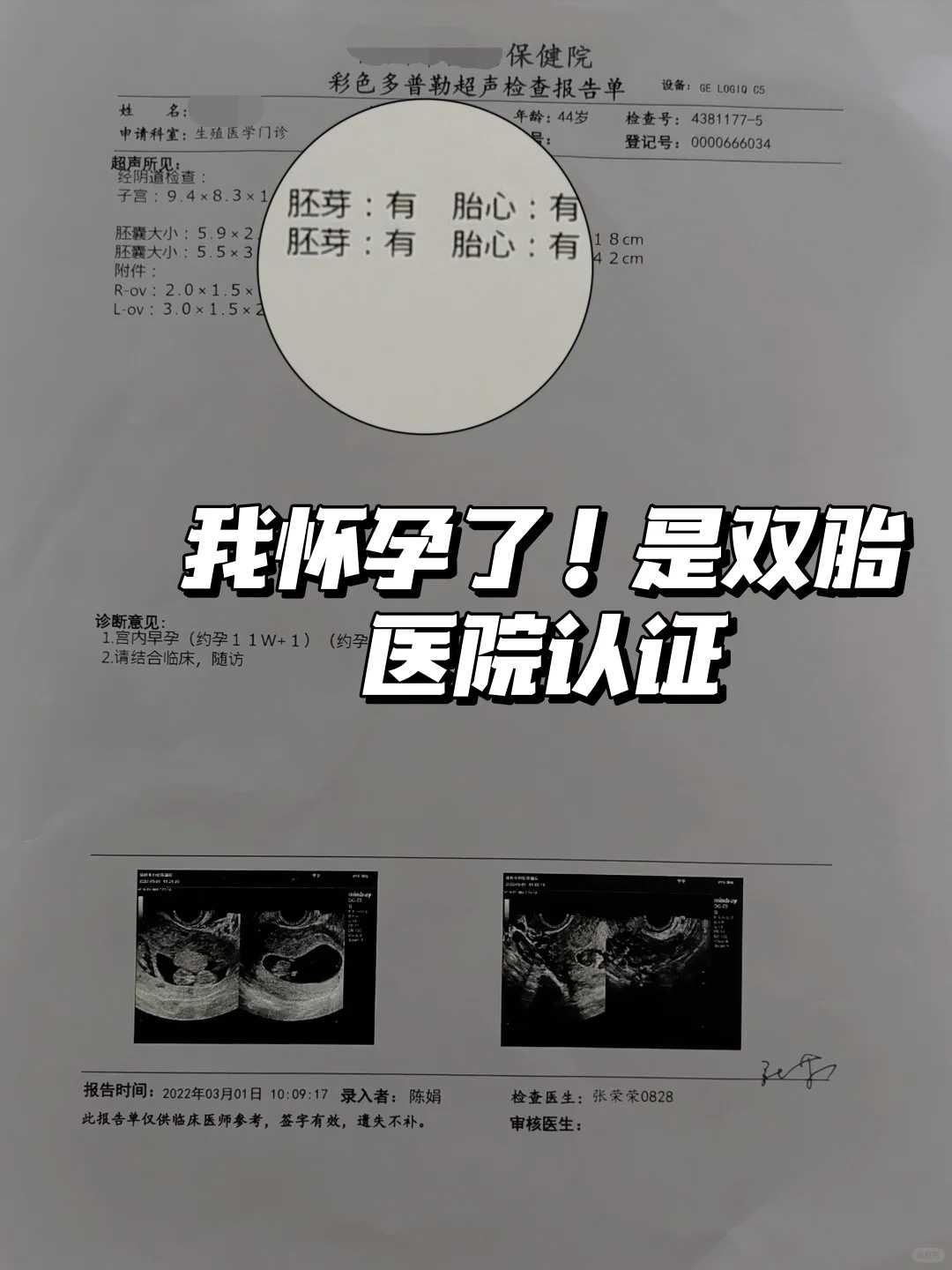 放生是每个月都放吗，8个月风雨不改每天放生，到头来什么也没有