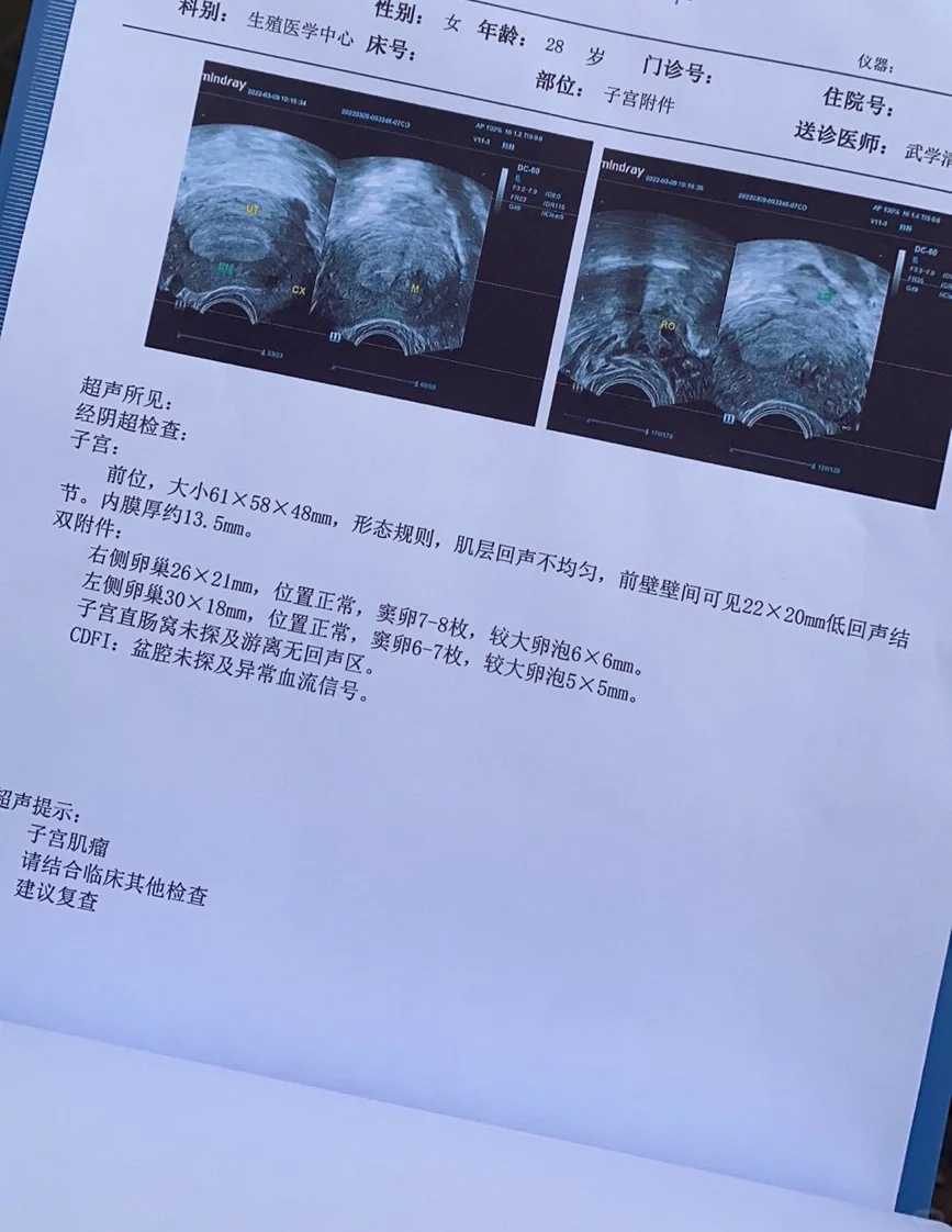 无锡端午节什么时间放生好，家里有小蜗牛如何放生