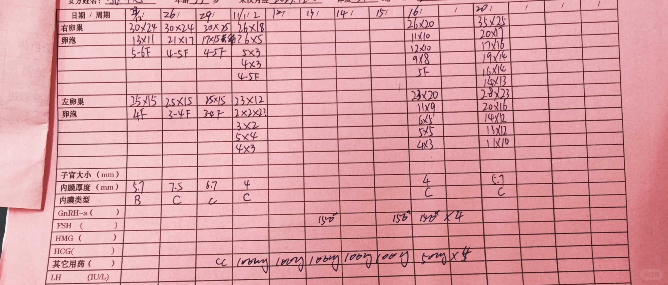 山东去哪里大放生,山东钓鱼然后放生 属于杀生吗,山东广州珠江适合放生什么鱼