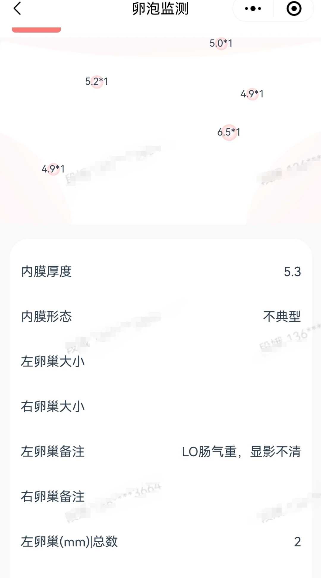 贵阳放生动物的意义（贵阳放生为什么不能放泥鳅鱼）