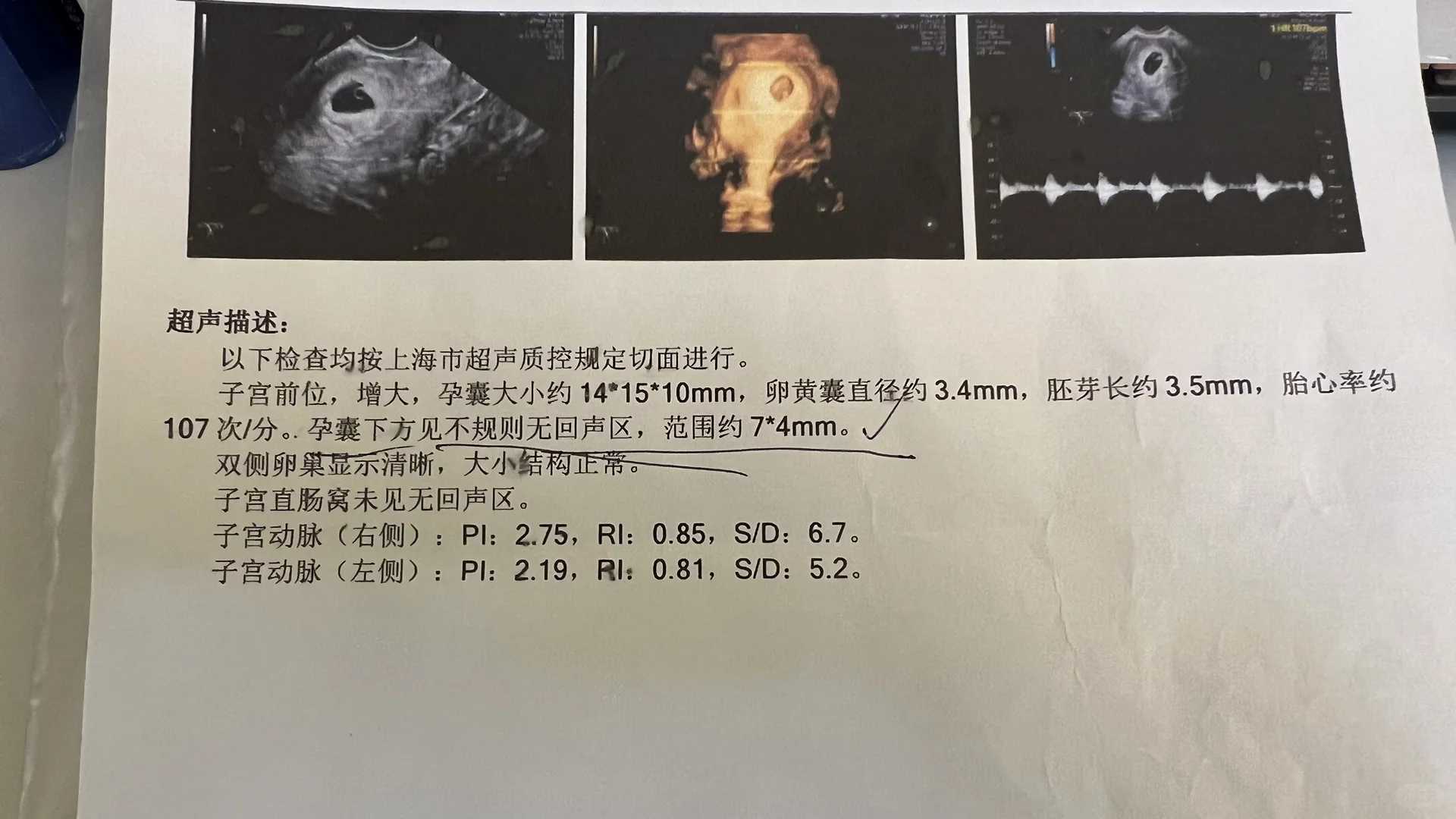 内蒙放生真实感应,内蒙放生鳖的好处和功效,内蒙东江放生台