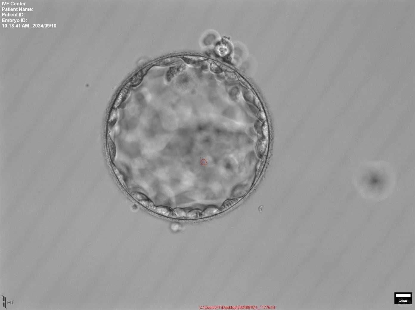 青岛哪里适合放生蚯蚓，青岛湛山寺方丈明哲长老安详示寂(图)